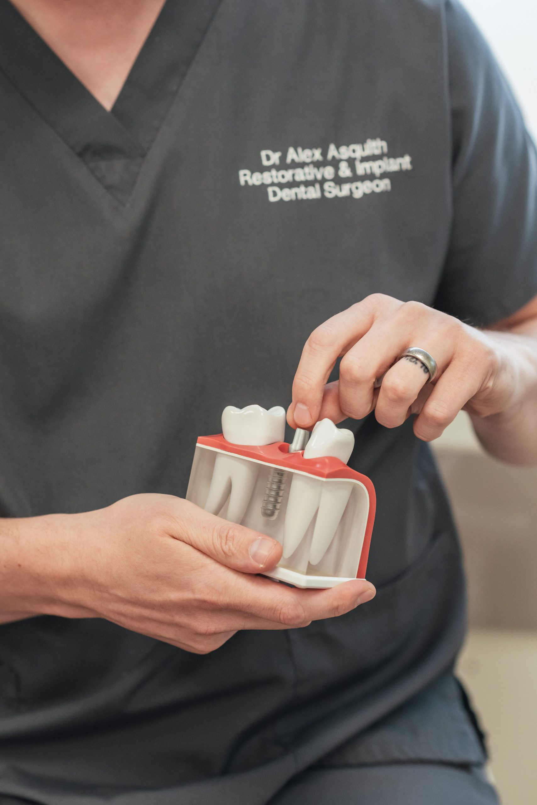 Dental Implants Leeds Garforth Enhance Dental Enhance Dental